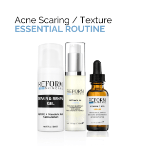 Essential skincare routine for acne scarring and texture improvement, featuring vitamin C serum, retinol 1% cream, and repair gel.